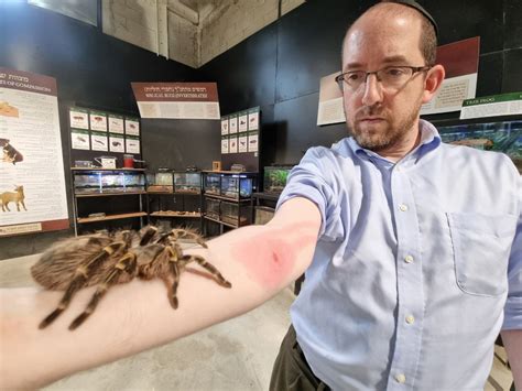 Rationalist Judaism The Significance Of A Spider Bite