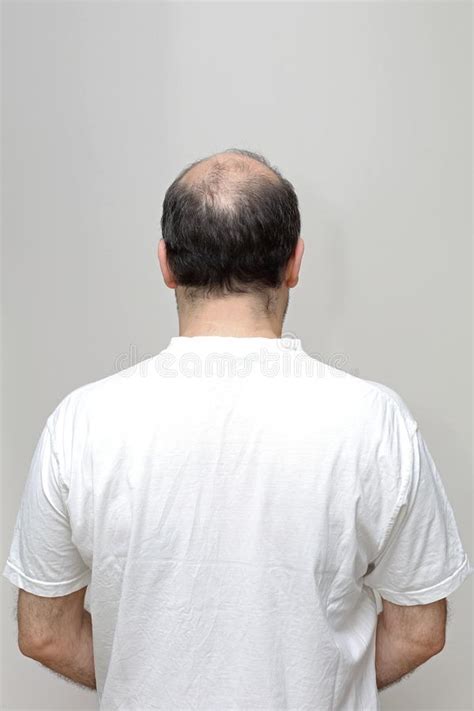 Back Bald Head Man Stock Photos Download 504 Royalty Free Photos