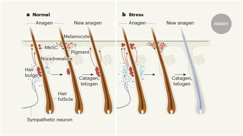 How The Stress Of Fight Or Flight Turns Hair White