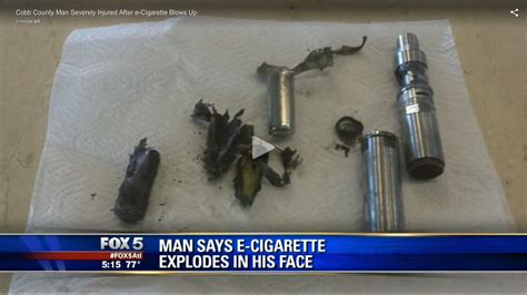 Mans E Cigarette Explodes In His Face