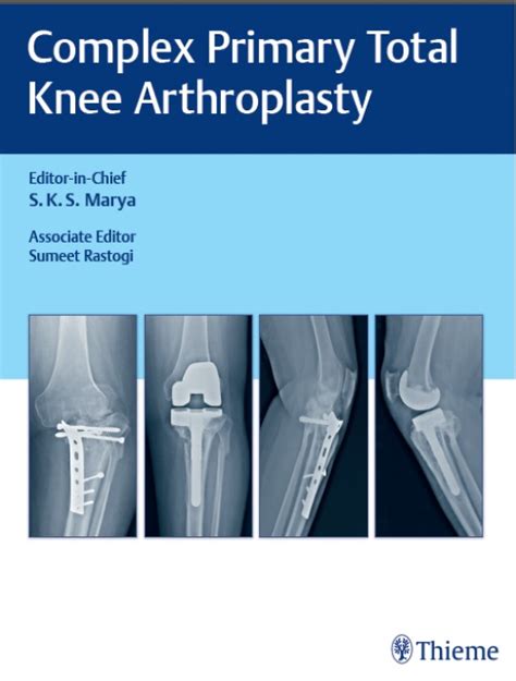 Complex Primary Total Knee Arthroplasty —