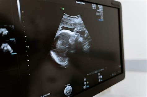 Sonogram Vs Ultrasound What Are The Differences