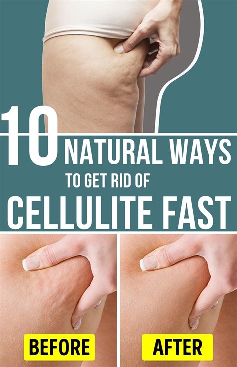 Natural Ways To Get Rid Of Cellulite Fast