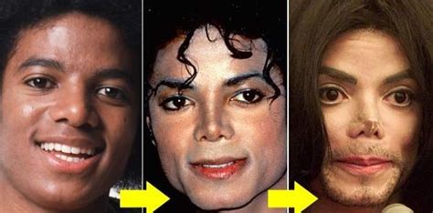 Michael Jackson Cosmetic Surgery Disaster Celebrity Plastic Surgery