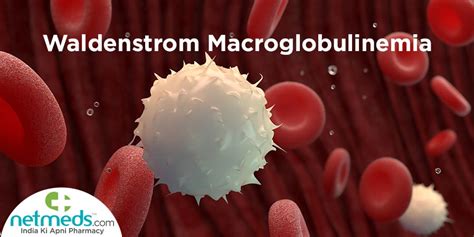 Waldenstrom Macroglobulinemia Causes Symptoms And Treatment