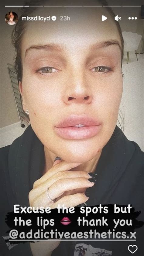 Danielle Lloyd Pouts In New Selfie As She Shows Off Fuller Lips After
