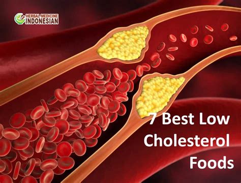 7 Best Low Cholesterol Foods Herb Medicine