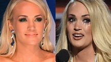 Carrie Underwood's face injury explained | Fox News