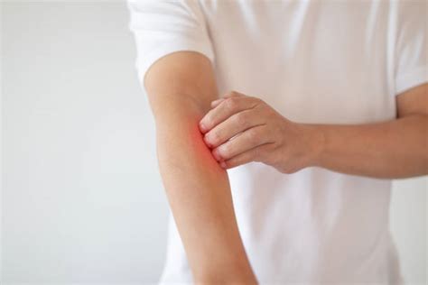Itchy Skin Stock Photos Pictures And Royalty Free Images Istock
