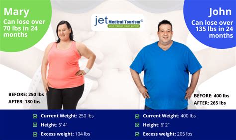 Gastric Bypass Weight Loss Chart Timeline 2022 2022