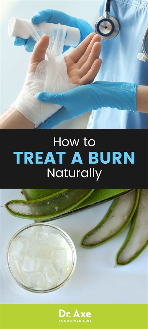 Wondering How To Treat A Burn At Home Im Sharing The Best Natural Remedies That Ca Home