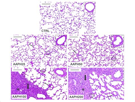 Pulmonary arteries and lung parenchyma sections, peripheral blood leukocytes, and plasma samples were obtained from all participants. | Photomicrographs of lung parenchyma stained with hematoxylin-eosin.... | Download Scientific ...