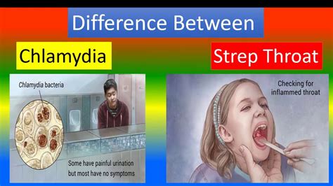 Syphilis In Throat Oral Stds Pictures Types Symptoms Treatment And