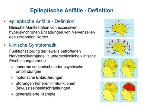 Ppt Epileptisches Anfallsgeschehen Und Demenz Powerpoint Presentation