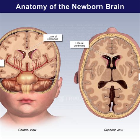 Anatomy Of The Newborn Brain Trialexhibits Inc