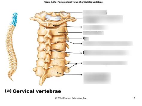Posterolateral View Of Articulated Vertebrae Diagram Quizlet