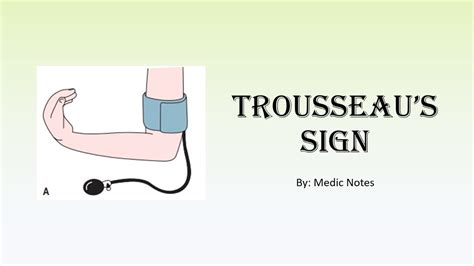 Trousseau S Sign Causes And Pathophysiology Hypocalcemia Respiratory