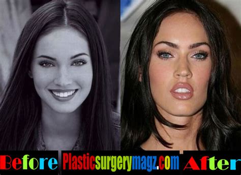 megan fox before and after plastic surgery megan fox tattoos removed plastic surgery magazine