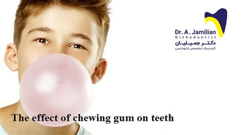 The Effect Of Chewing Gum On Teeth Dr Jamilian