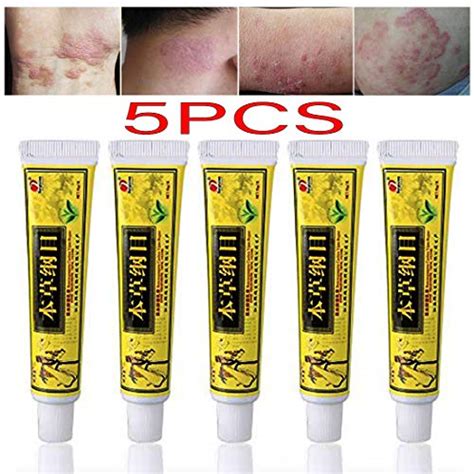 Buy 5pcslot High Quality Chinese Al Eczema Psoriasis Creams