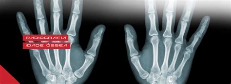 Radiografia De Mão E Punho Unimagem Radiografia Odontológica Curitiba