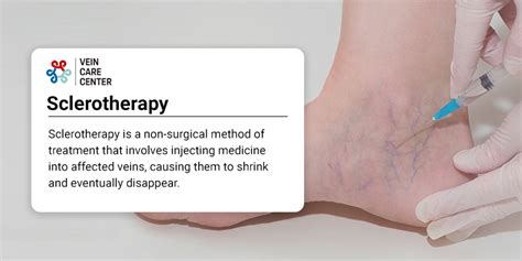 Sclerotherapy For Spider Veins In Nyc Vein Care Center