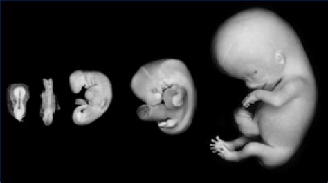 Photographs Of Human Embryos At Five Stages Of Gestation Reproduced