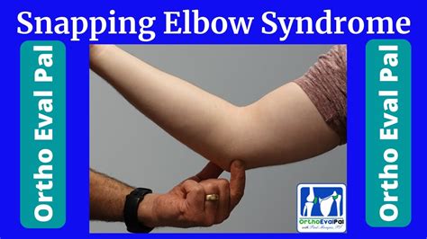 Snapping Elbow Syndrome Youtube
