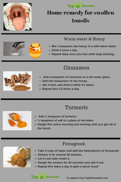 Home Remedy For Swollen Tonsils And Sore Throat