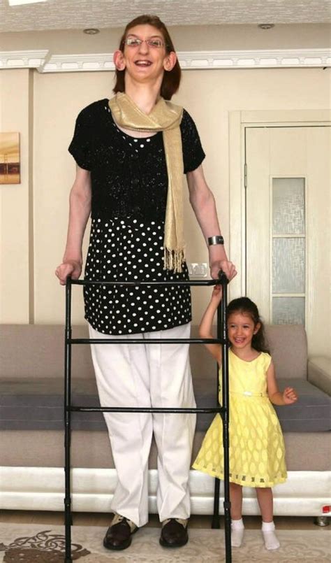 Meet Worlds Tallest Woman Rumeysa Gelgi Shesight