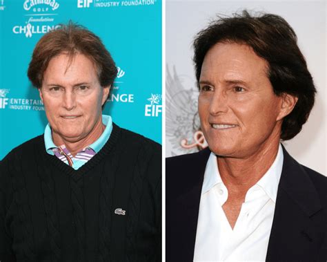 Transition Caitlyn Jenner Before And After Renitalexander