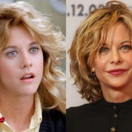 Meg Ryan Before And After Cosmetic Surgery X Cosmetic Surgery