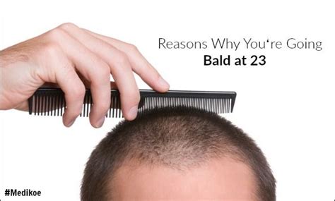 Here Are Some Reasons Why Youre Going Bald At 23 Hairfall Hairloss