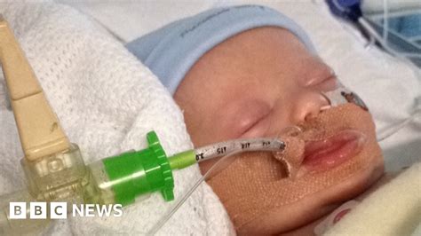 Mum With Baby Not Breathing Asked To Wait By Receptionist Bbc News