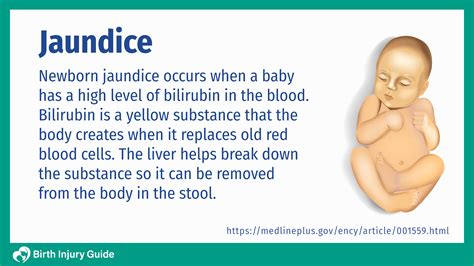 What Is Jaundice In Babies Mean Shantel Bedford