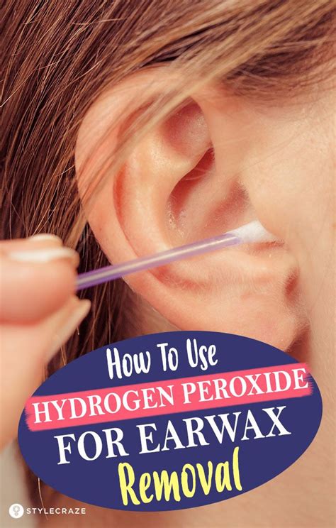 Using Hydrogen Peroxide For Earwax Removal Safe Or Not Ear Wax