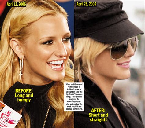 Chatter Busy Ashlee Simpson Nose Job