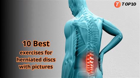 10 Best Exercises For Herniated Discs With Pictures