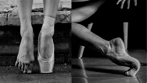 Ballerina Feet Conditions That Cause Ballerina Feet Damage