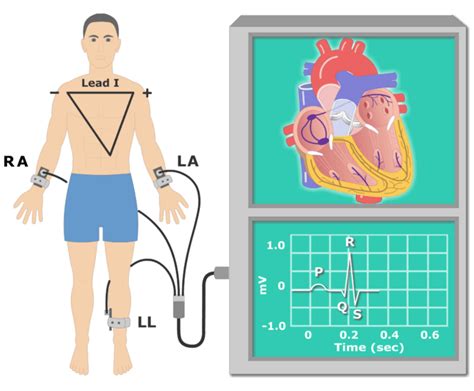 The Electrocardiogram Ekg Or Ecg Animation And Diagram Getbodysmart