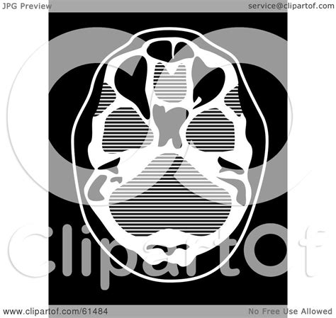Here you can explore hq ct scan transparent illustrations, icons and clipart with filter setting like polish your personal project or design with these ct scan transparent png images, make it even. Royalty-free (RF) Clipart Illustration of a Black And ...