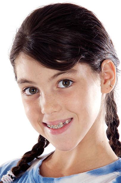 100 Braces And Pigtails Stock Photos Pictures And Royalty Free Images