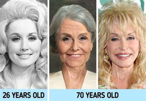 Dolly Parton Plastic Surgery Procedures And Insights Plasticsurgeryinsights Com