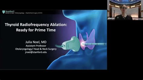Thyroid Radiofrequency Ablation Ready For Prime Time Youtube
