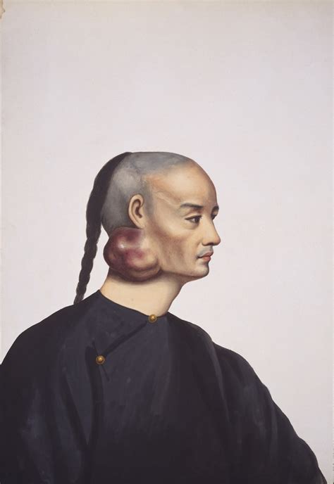 The Medical Portraiture Of Lam Qua Palatino Press