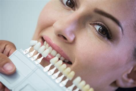 dental veneers porcelain veneer procedure benefits and more