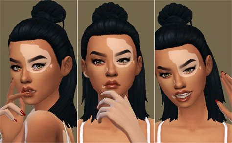 So I Made A Model For My Vitiligo Overlay Cc And I Love Her Sims4