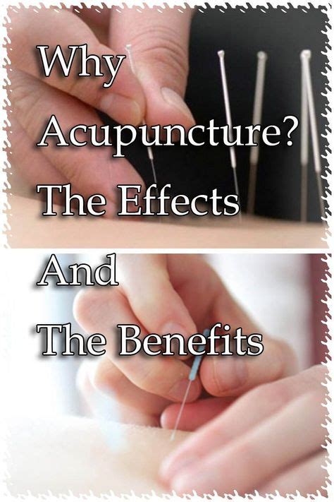 Health Benefits Of Acupuncture Acupressure And Acupuncture Benefits