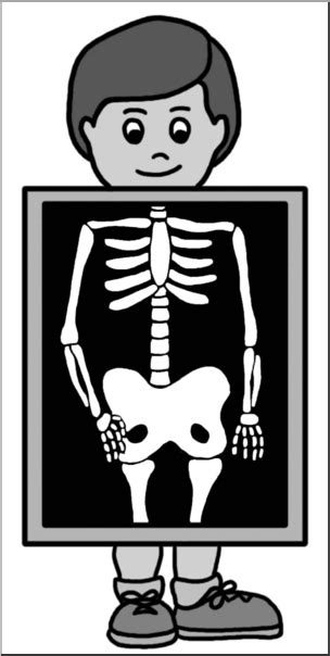 Xray Clip Art Black And White Hot Sex Picture