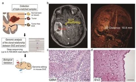 Study Origin Cells For Deadly Brain Tumors Identified — Details Tdnews